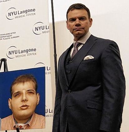 <p>Dr. Eduardo Rodriguez und ein Bild von Hardison nach der OP.</p>