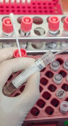 Im Labor wird eine Probe auf das Coronavirus getestet. Experten gehen davon aus, dass die Zahl der Infizierten noch deutlich steigen wird.