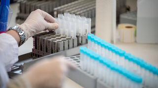 Eine Labormitarbeiterin bereitet Teströhrchen für einen PCR-Test vor. (Symbolbild)