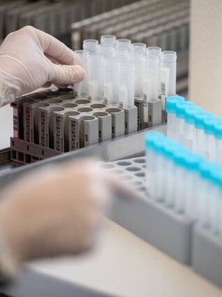 Eine Labormitarbeiterin bereitet Röhrchen für PCR-Tests vor. Immer mehr positive Fälle werden der neuen Virusvariante Omikron zugerechnet.