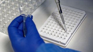 Die Inzidenzen in der Region sind gestiegen. Hier ist ein PCR-Test zu sehen.