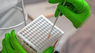 Hochtechnisierter Kampf gegen Leukämie: Wattestäbchen zur DNA-Typisierung für Knochenmarkspenden.