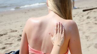 «Das Risiko, einen Sonnenbrand zu bekommen, ist abhängig vom Sonnenstand und in den Sommermonaten von Juni bis August sowie in der Mittagszeit zwischen 11 und 15 Uhr besonders hoch», sagte der Dermatologe Mark Berneburg der Deutschen Presse-Agentur.