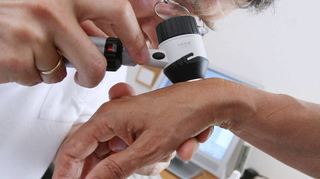 Ein Arzt untersucht die Haut einer Patientin bei einer Krebs-Früherkennung. Die Fallzahlen steigen - auch in Mannheim.