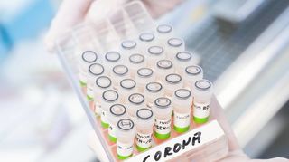 In die Statistik fließen nur Infektionen ein, die per PCR-Test (hier in einem Labor aufbereitet) bestätigt sind. Die Dunkelziffer dürfte also hoch sein.