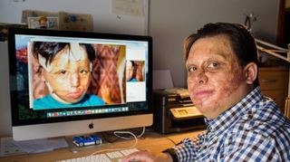 Marc-David Jung mit einem Bild, das ihn als Kind zeigt. Seine Mutter barg den brennenden Jungen, der unter Wrackteilen lag.