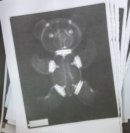 Das Röntgenbild eines Teddys liegt im Teddybärkrankenhaus in der ehemaligen Notaufnahme der Uniklinik Halle/Saale. An der Universitätsmedizin werden in diesen Tagen bereits zum 20. Mal Kuscheltiere verarztet. Dabei sticht das Teddybärkrankenhaus in Halle dadurch hervor, dass am Medizin-Campus Steintor ein kompletter ehemaliger Krankenhaustrakt mit mehreren echten OP-Räumen genutzt wird. Ziel des Projekts sei es, Kindern spielerisch die Angst vor einem Arztbesuch zu nehmen. Erneut werden Hunderte Kinder erwartet. Die Teddyklinik läuft noch bis Freitag. +++ dpa-Bildfunk +++