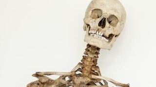 Dieses Skelett der Anatomischen Sammlung der Universität Heidelberg wurde durch neue Forschungsergebnisse eindeutig dem bekannten Räuber „Schinderhannes" alias Johannes Bückler zugeordnet. Zuvor wurde angenommen, dass es sich dabei um das Skelett des „Schwarzen Jonas“ handelt.