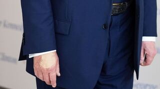 Für Trump ein unliebsames Thema: die überschminkte Hand (Archivbild).