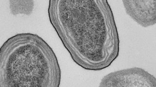 Elektronenmikroskopische Aufnahme von Prochlorococcus-Zellen.
