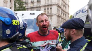An mehreren Stellen kam es zu Zusammenstößen mit der Polizei.