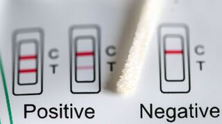 Positiv oder negativ - das zeigt ein Test an. (Symbolbild)