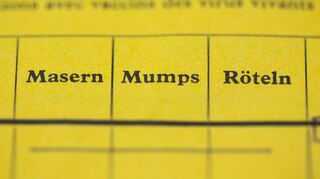 Gegen Masern, Mumps und Röteln gibt es auch Kombi-Impfstoffe. (Symbolbild)